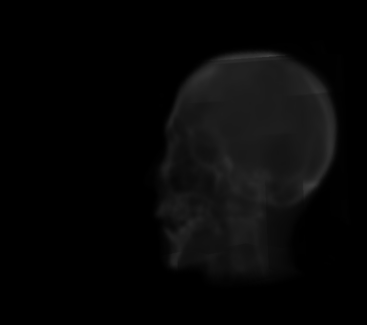 xray.png